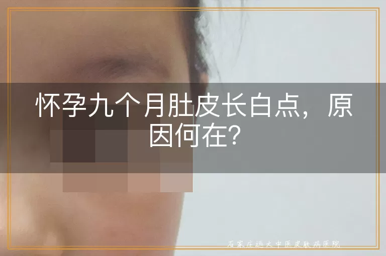 怀孕九个月肚皮长白点，原因何在？