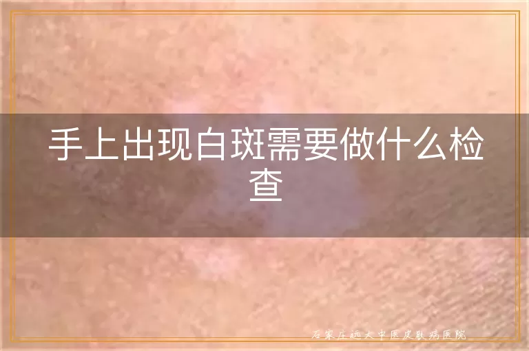 手上出现白斑需要做什么检查