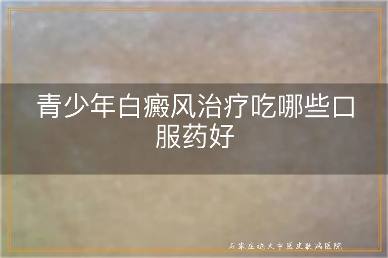 青少年白癜风治疗吃哪些口服药好