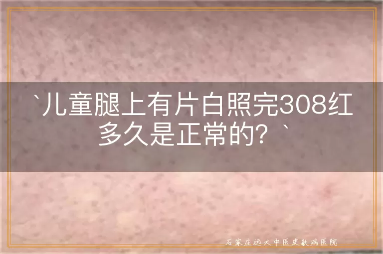 儿童腿上有片白照完308红多久是正常的？