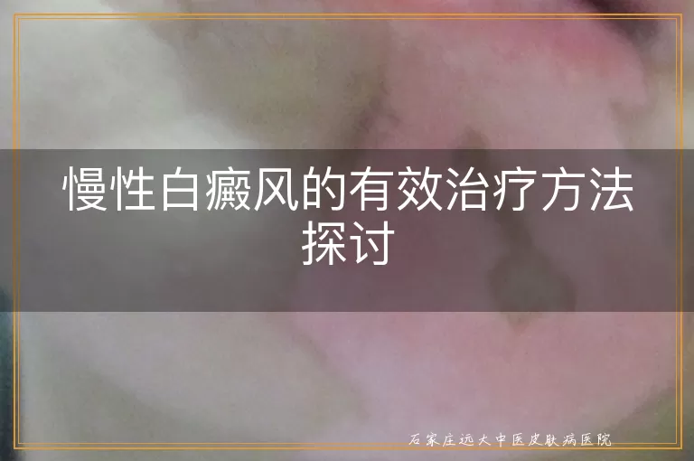 慢性白癜风的有效治疗方法探讨