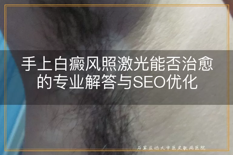 手上白癜风照激光能否治愈的专业解答与SEO优化