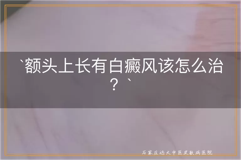 额头上长有白癜风该怎么治？