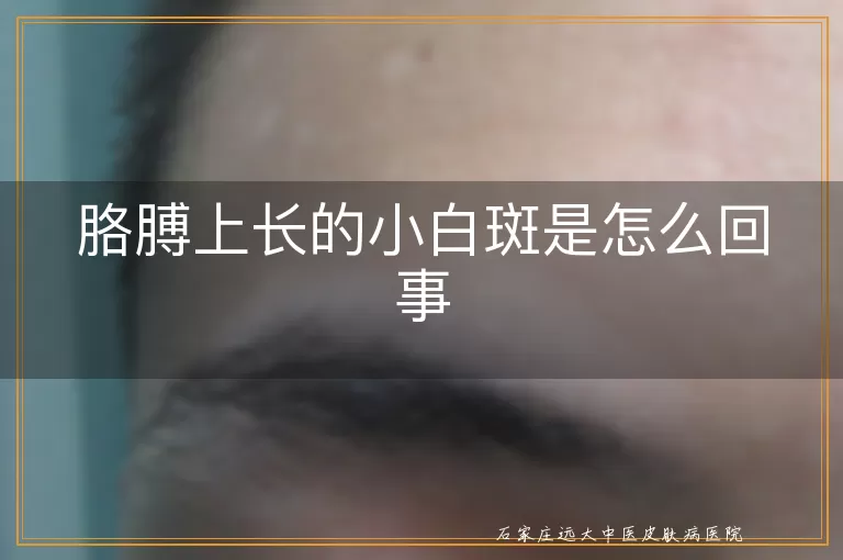 胳膊上长的小白斑是怎么回事