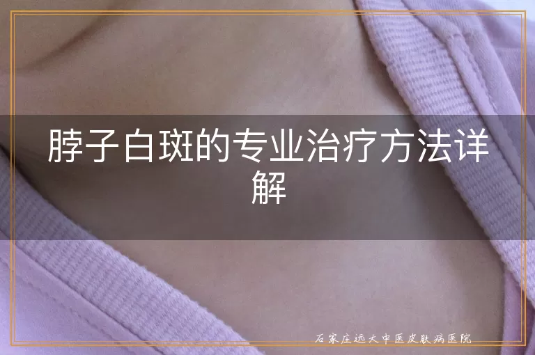 脖子白斑的专业治疗方法详解