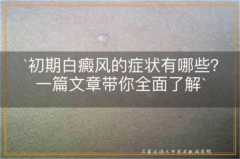 初期白癜风的症状有哪些？一篇文章带你全面了解