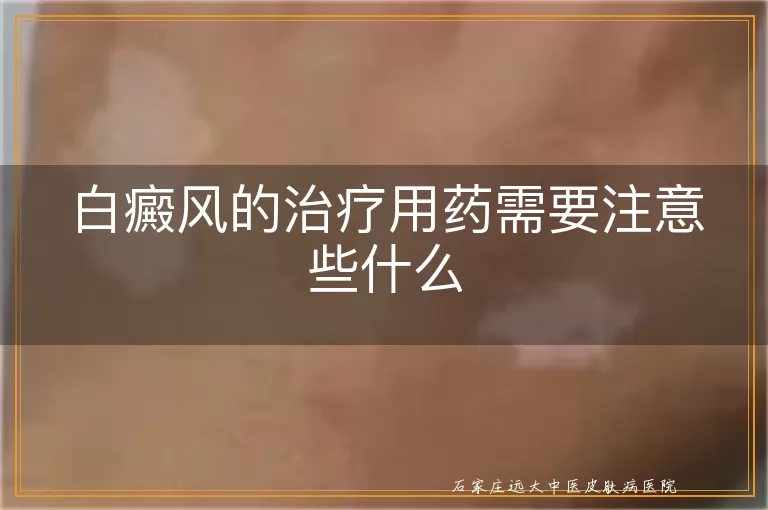 白癜风的治疗用药需要注意些什么