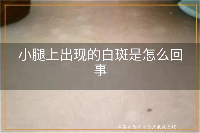 小腿上出现的白斑是怎么回事