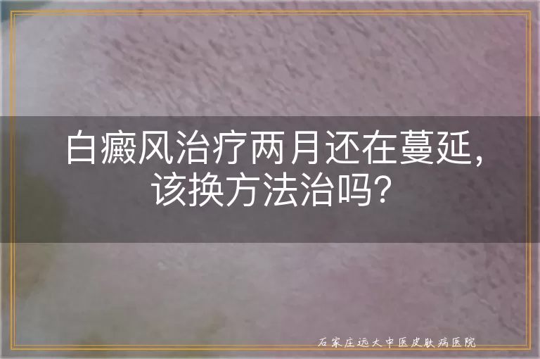 白癜风治疗两月还在蔓延，该换方法治吗？