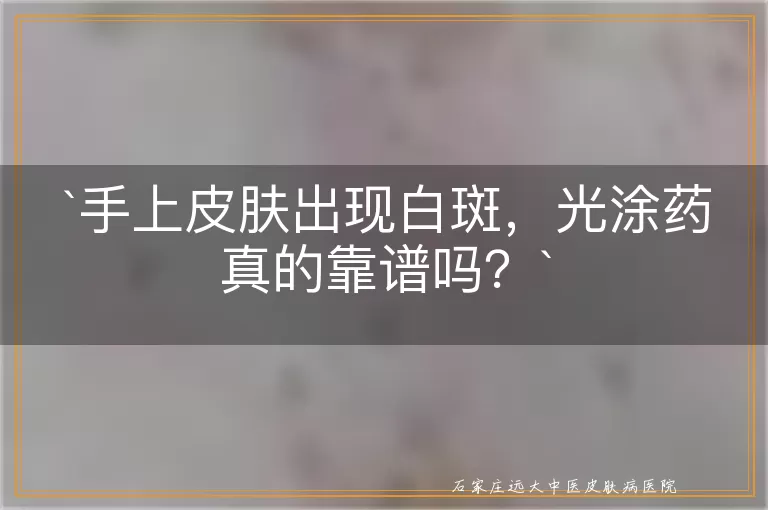 手上皮肤出现白斑，光涂药真的靠谱吗？