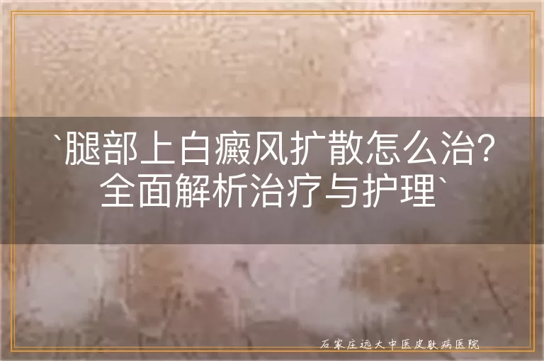 腿部上白癜风扩散怎么治？全面解析治疗与护理