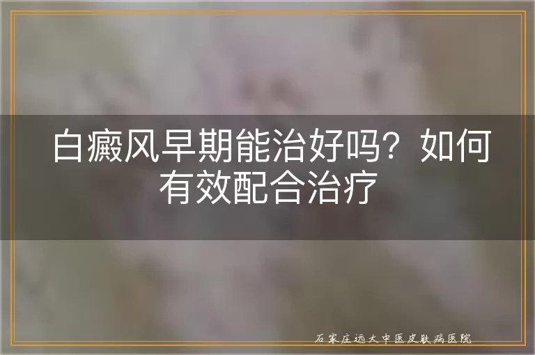 白癜风早期能治好吗？如何有效配合治疗