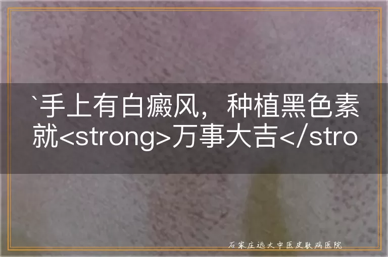 手上有白癜风，种植黑色素就<strong>万事大吉</strong>了吗？