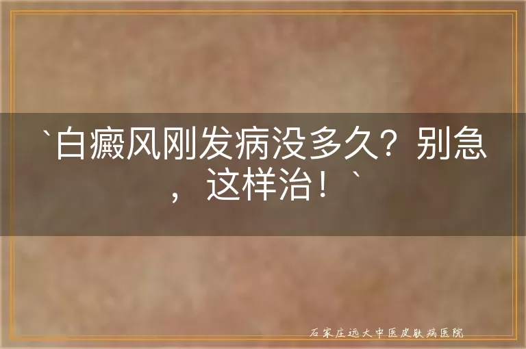 白癜风刚发病没多久？别急，这样治！