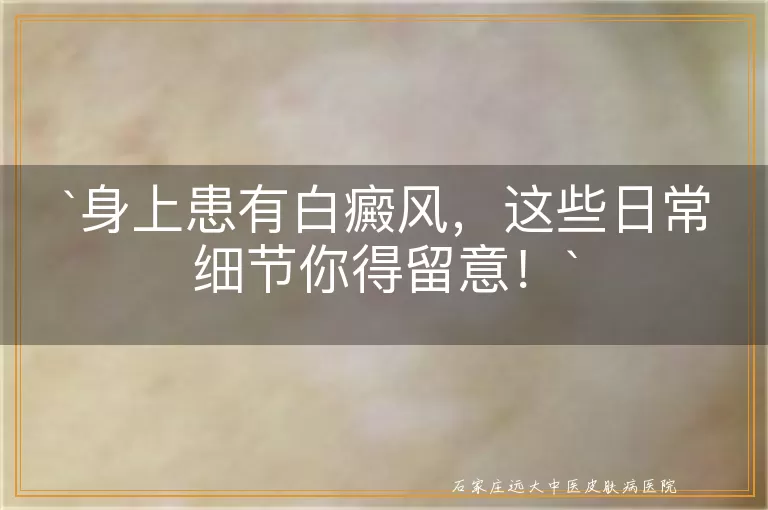 身上患有白癜风，这些日常细节你得留意！