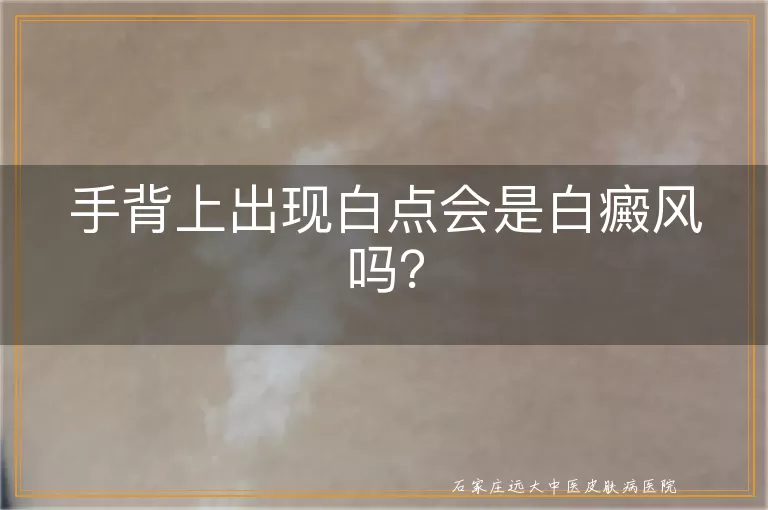 手背上出现白点会是白癜风吗？