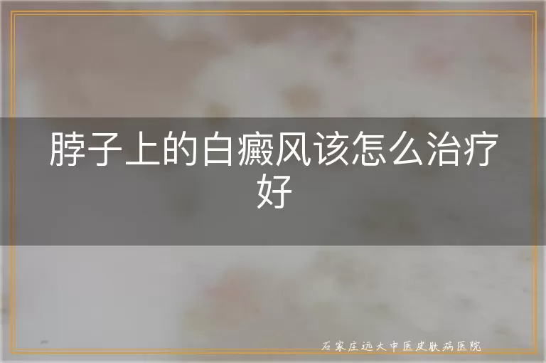 脖子上的白癜风该怎么治疗好