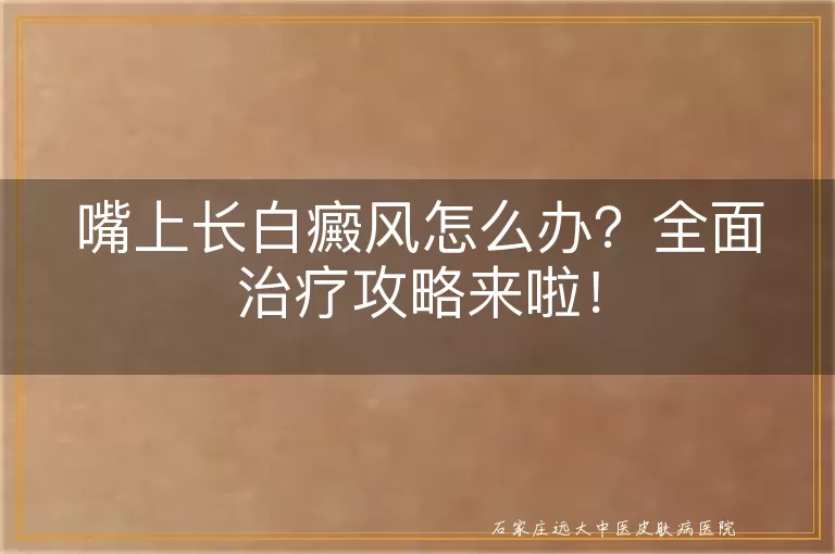 嘴上长白癜风怎么办？全面治疗攻略来啦！