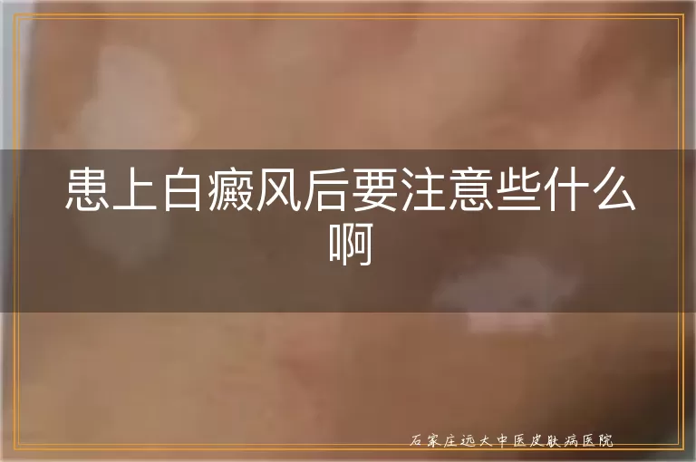 患上白癜风后要注意些什么啊