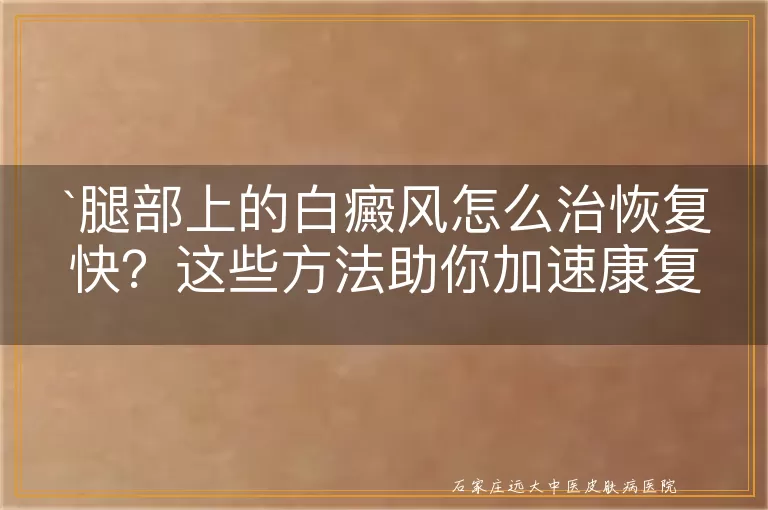 腿部上的白癜风怎么治恢复快？这些方法助你加速康复！