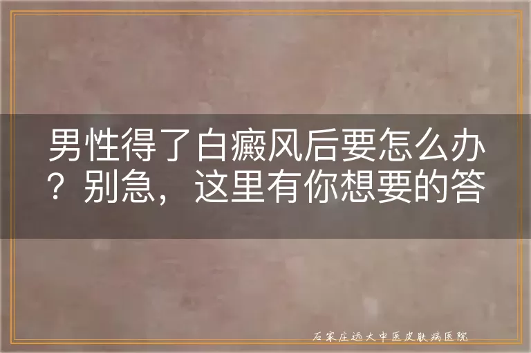 男性得了白癜风后要怎么办？别急，这里有你想要的答案！